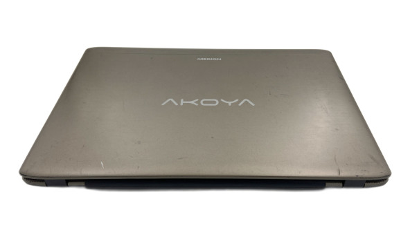Ноутбук Medion E7416 Intel Core i5-5200U 8GB RAM 120SSD + 1000GB HDD [17.3"] - ноутбук Б/У - 283976